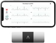 KardiaMobile 6-Lead Personal EKG Monitor – Six Views of The Heart – Detects AFib and Irregular Arrhythmias – Instant Results in 30 Seconds – Works with Most Smartphones – FSA/HSA Eligible